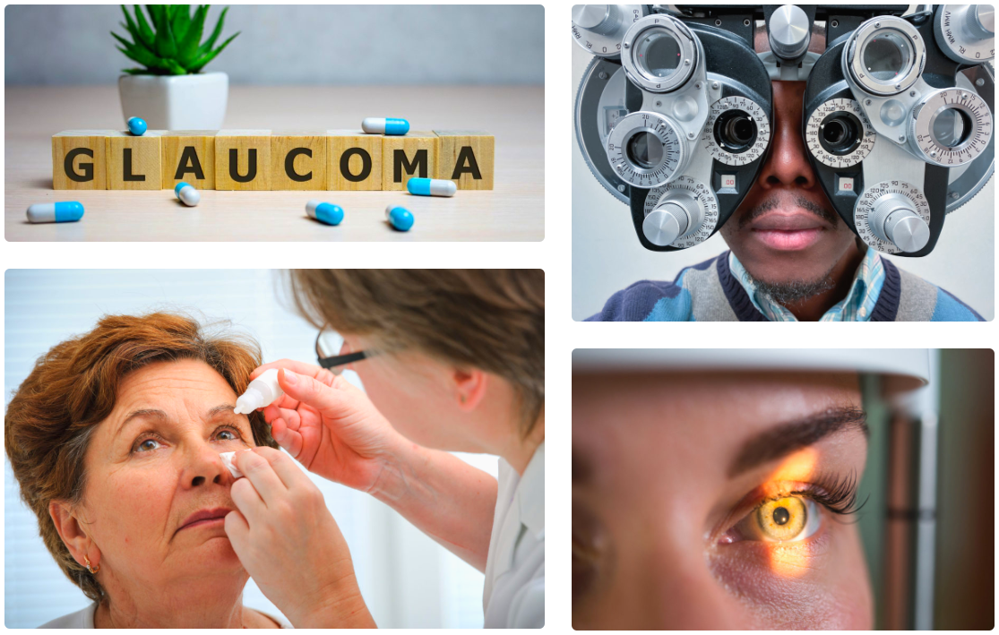 Diagnosis Glaucoma - A Podcast for Anyone Interested in Glaucoma